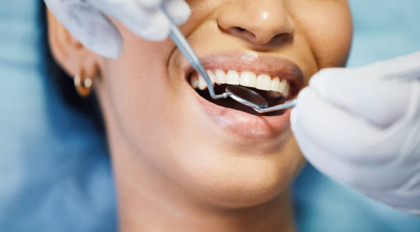 Best Lost Filling or Crown Replacement in Stanhope, NJ